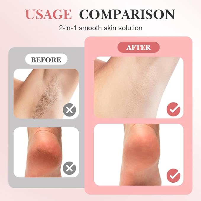 2-in-1 Electric Foot File – Dead Skin & Callus Remover