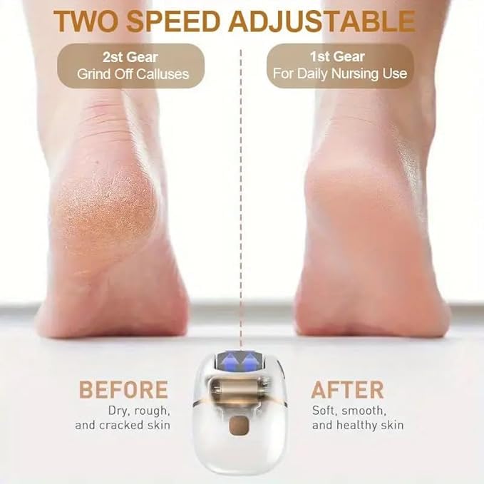 Rechargeable Electric Foot File – 2 Speeds 🦶✨