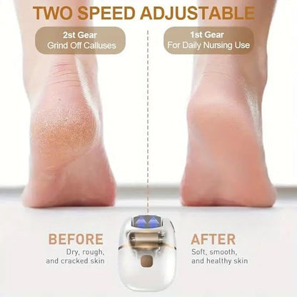Rechargeable Electric Foot File – 2 Speeds 🦶✨