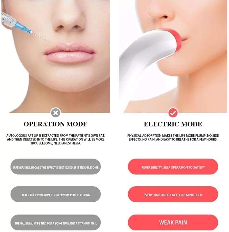 Lip Augmentation Device