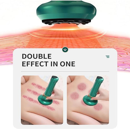 EMS Cellulite Massager – LED Body Sculpting & Skin Tightening Device ✨💆‍♀️