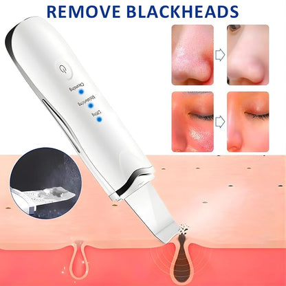 Ultrasonic Skin Scrubber – Deep Facial Cleansing Device ✨💆‍♀️