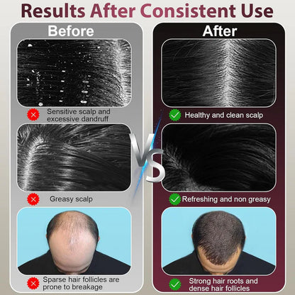 Laser Therapy Hair Growth Comb